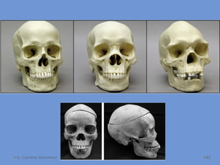 D. Caroline Mohamed 82
 