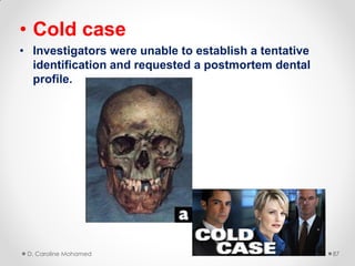 • Cold case
• Investigators were unable to establish a tentative
identification and requested a postmortem dental
profile.
D. Caroline Mohamed 87
 