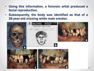 • Using this information, a forensic artist produced a
facial reproduction.
• Subsequently, the body was identified as that of a
28-year-old missing white male smoker.
D. Caroline Mohamed 90
 