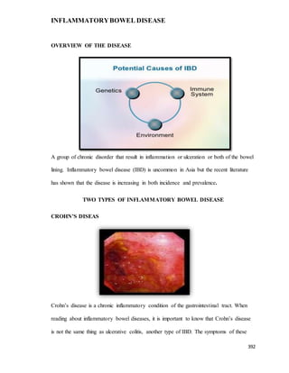 INFLAMMATORYBOWEL DISEASE
392
OVERVIEW OF THE DISEASE
A group of chronic disorder that result in inflammation or ulceration or both of the bowel
lining. Inflammatory bowel disease (IBD) is uncommon in Asia but the recent literature
has shown that the disease is increasing in both incidence and prevalence.
TWO TYPES OF INFLAMMATORY BOWEL DISEASE
CROHN’S DISEAS
Crohn’s disease is a chronic inflammatory condition of the gastrointestinal tract. When
reading about inflammatory bowel diseases, it is important to know that Crohn’s disease
is not the same thing as ulcerative colitis, another type of IBD. The symptoms of these
 