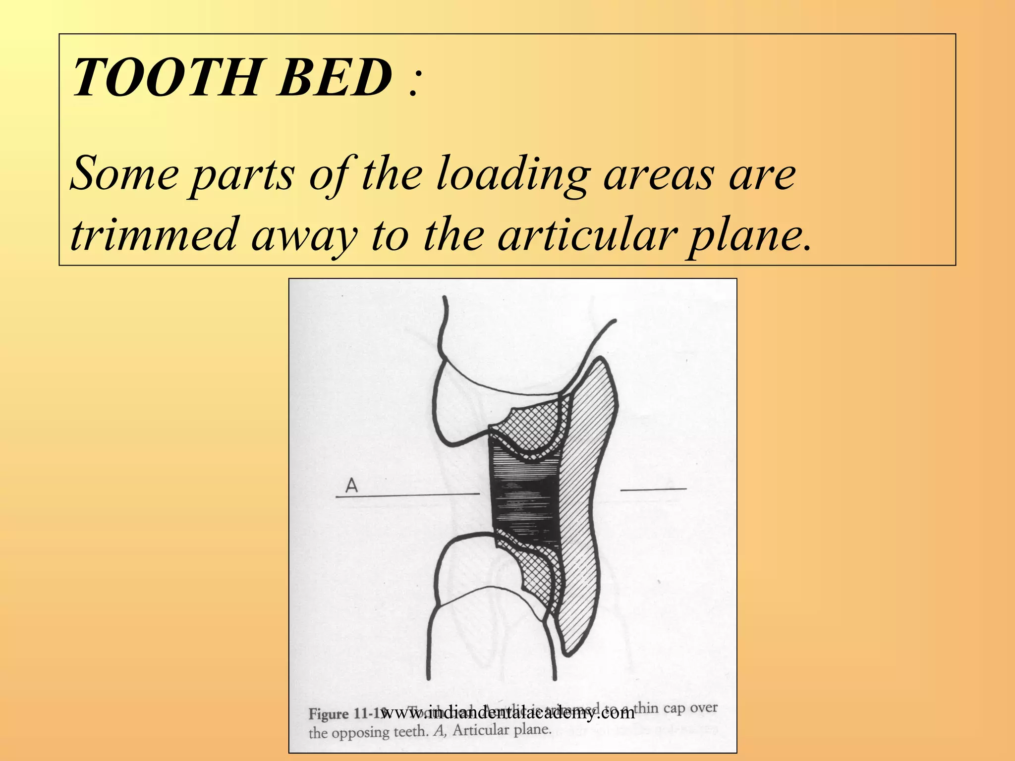 TOOTH BED :
Some parts of the loading areas are
trimmed away to the articular plane.
www.indiandentalacademy.com
 