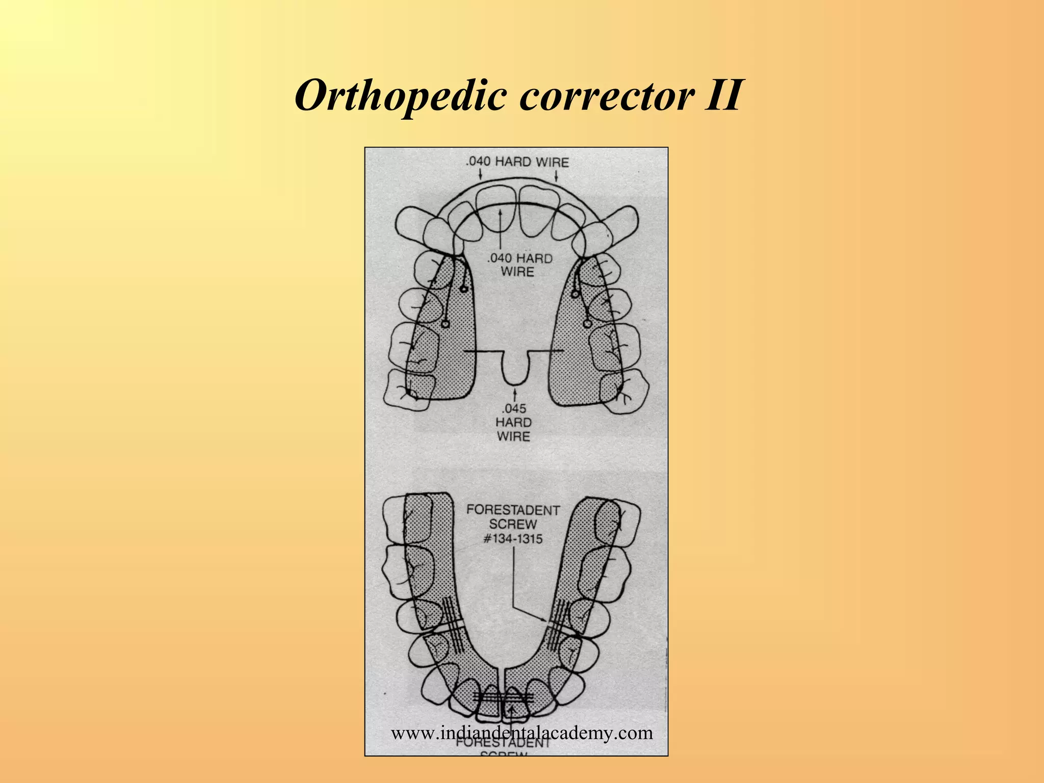 Orthopedic corrector II
www.indiandentalacademy.com
 