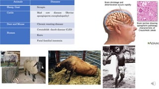 Animals Diseases
Sheep, Goat Scrapie
Cattle Mad cow disease (Bovine
spongisperm encephalopathy)
Deer and Mouse Chronic wasting disease
Human
Creutzfeldt -Jacob disease (CJD)
Kuru
Fatal familial insomnia
 