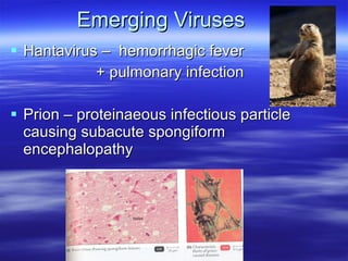 Emerging Viruses Hantavirus –  hemorrhagic fever  + pulmonary infection Prion – proteinaeous infectious particle causing subacute spongiform encephalopathy  