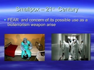 Smallpox – 21 st   Century FEAR  and concern of its possible use as a bioterrorism weapon arise 