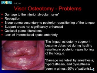 33.reconstructive preprosthetic surgery (n) | PPT
