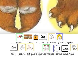 Tiene bultos en las rodillas pobre infeliz
los
las
los dedos del pie desparramados como una raíz
una
 