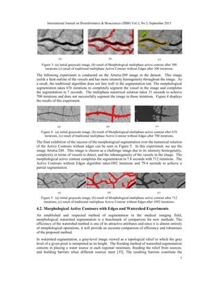 International Journal on Bioinformatics & Biosciences (IJBB) Vol.3, No.3, September 2013
7
(a) (b) (c)
Figure 3: (a) initial grayscale image, (b) result of Morphological multiphase active contour after 300
iterations (c) result of traditional multiphase Active Contour without Edges after 300 iterations.
The following experiment is conducted on the Arteria-209 image in the dataset. This image
yields a faint outline of the vessels and has more intensity homogeneity throughout the image. As
a result, the traditional algorithm does not fare well in the segmentation test. The morphological
segmentation takes 676 iterations to completely segment the vessel in the image and completes
the segmentation in 7 seconds. The multiphase numerical solution takes 31 seconds to achieve
700 iterations and does not successfully segment the image in those iterations. Figure 4 displays
the results of this experiment.
(a) (b) (c)
Figure 4: (a) initial grayscale image, (b) result of Morphological multiphase active contour after 676
iterations, (c) result of traditional multiphase Active Contour without Edges after 700 iterations.
The final exhibition of the success of the morphological segmentation over the numerical solution
of the Active Contours without edges can be seen in Figure 5. In this experiment, we use the
image Arteria-248. This image is chosen as a challenge image due to its intensity homogeneity,
complexity in terms of vessels to detect, and the inhomogeneity of the vessels in the image. The
morphological active contour completes the segmentation in 7.8 seconds with 712 iterations. The
Active Contours without Edges algorithm takes1092 iterations and 79.4 seconds to achieve a
partial segmentation.
(a) (b) (c)
Figure 5: (a) initial grayscale image, (b) result of Morphological multiphase active contour after 712
iterations, (c) result of traditional multiphase Active Contour without Edges after 1092 iterations.
4.2. Morphological Active Contours with Edges and Watershed Experiments
An established and respected method of segmentation in the medical imaging field,
morphological watershed segmentation is a benchmark of comparison for new methods. The
efficiency of the watershed method is one of its attractive attributes and since it is almost entirely
of morphological operations, it will provide an accurate comparison of efficiency and robustness
of the proposed method.
In watershed segmentation, a gray-level image viewed as a topological relief in which the gray
level of a given pixel is interpreted as its height. The flooding method of watershed segmentation
consists in placing a water source in each regional minimum, flooding the relief from sources,
and building barriers when different sources meet [35]. The resulting barriers constitute the
 