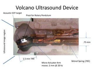 Volcano Ultrasound Device
Ultrasoundimageregion
Pivot for Rotary Pendulum
1.5 mm TRX
.75 mm
Nitinol Spring (70C)
Micro-Actuator Arm
moves .5 mm @ 20 hz
Acoustic EOT target
 