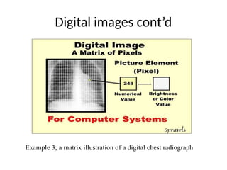 Digital images cont’d
Example 3; a matrix illustration of a digital chest radiograph
 