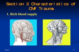 1. Rich blood supply Section 2 Characteristics of OMF Trauma 