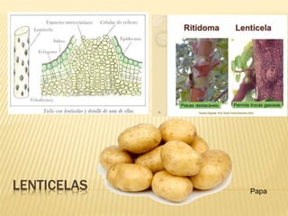 LENTICELAS Papa
 