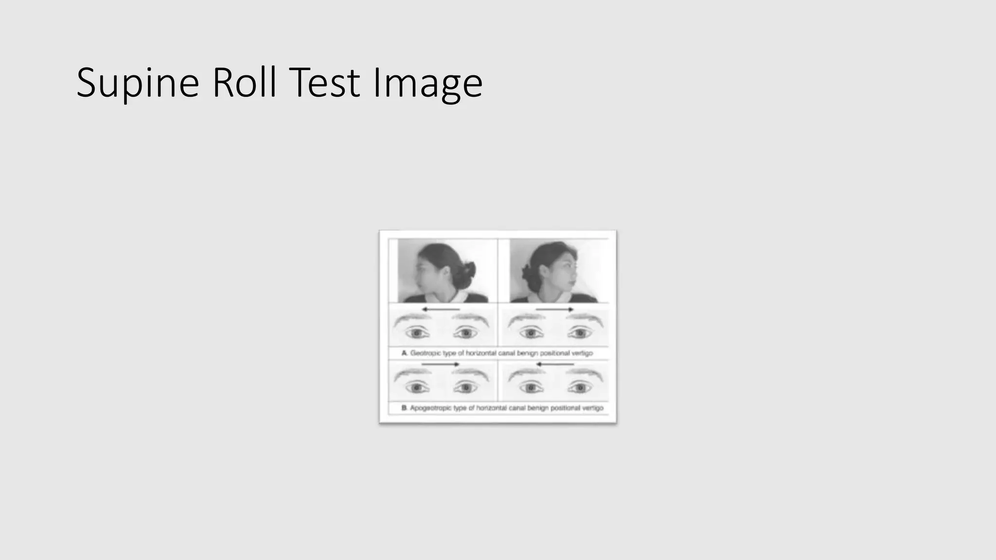 Supine Roll Test Image
 