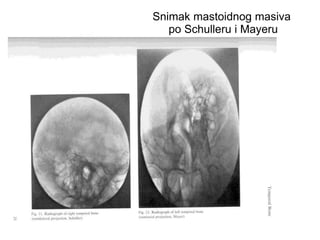 Snimak mastoidnog masiva
po Schulleru i Mayeru
 