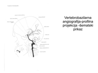 Vertebrobazilarna
angiografija-profilna
projekcija -šematski
prikaz
 