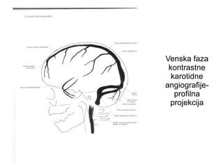 Venska faza
kontrastne
karotidne
angiografije-
profilna
projekcija
 