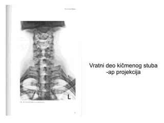 Vratni deo kičmenog stuba
-ap projekcija
 