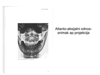 Atlanto-aksijalni odnos-
snimak ap projekcija
 