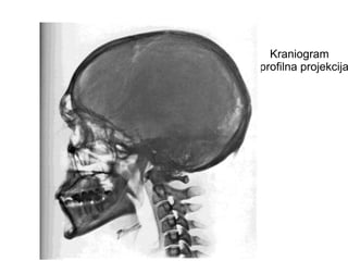 Kraniogram
– profilna projekcija
 