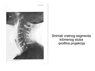 Snimak vratnog segmenta
kičmenog stuba
-profilna projekcija
 
