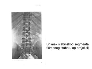 Snimak slabinskog segmenta
kičmenog stuba u ap projekciji
 