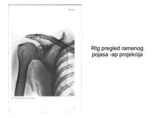 Rtg pregled ramenog
pojasa -ap projekcija
 