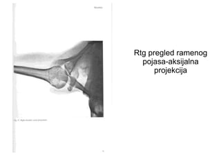 Rtg pregled ramenog
pojasa-aksijalna
projekcija
 
