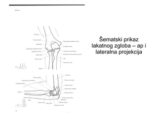 Šematski prikaz
lakatnog zgloba – ap i
lateralna projekcija
 