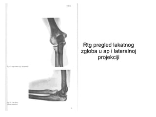Rtg pregled lakatnog
zgloba u ap i lateralnoj
projekciji
 
