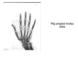 Rtg pregled kostiju
šake
 