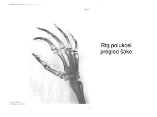 Rtg polukosi
pregled šake
 