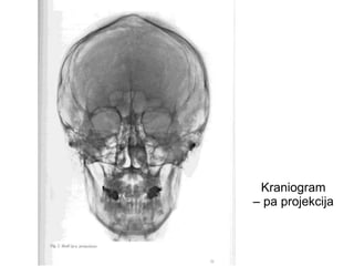 Kraniogram
– pa projekcija
 