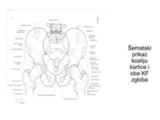 Šematski
prikaz
kostiju
karlice i
oba KF
zgloba
 