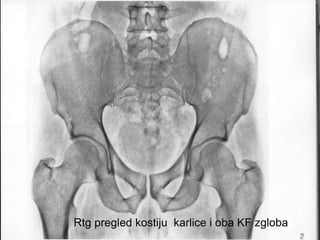 Kosti karlice sa oba kf zgloba
Rtg pregled kostiju karlice i oba KF zgloba
 
