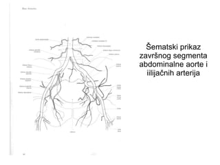 Šematski prikaz
završnog segmenta
abdominalne aorte i
iilijačnih arterija
 