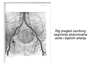Rtg pregled završnog
segmenta abdominalne
aorte i ilijačnih arterija
 