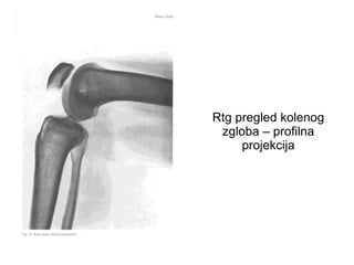 Rtg pregled kolenog
zgloba – profilna
projekcija
 
