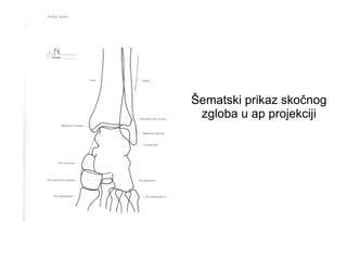 Šematski prikaz skočnog
zgloba u ap projekciji
 