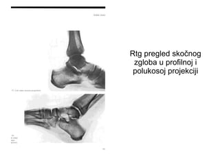 Rtg pregled skočnog
zgloba u profilnoj i
polukosoj projekciji
 