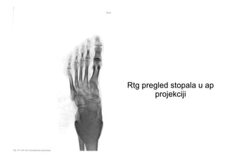 Rtg pregled stopala u ap
projekciji
 
