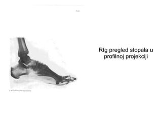 Rtg pregled stopala u
profilnoj projekciji
 