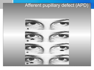 Comprehensive Overview of Neuro-Ophthalmology: Diagnosis and Management ...
