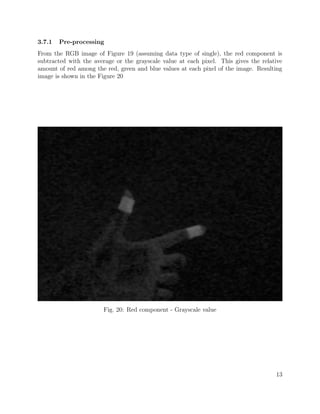 3.7.1 Pre-processing
From the RGB image of Figure 19 (assuming data type of single), the red component is
subtracted with the average or the grayscale value at each pixel. This gives the relative
amount of red among the red, green and blue values at each pixel of the image. Resulting
image is shown in the Figure 20
Fig. 20: Red component - Grayscale value
13
 
