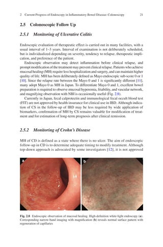 Advances In Endoscopy In Inflammatory Bowel Disease Toshiumi Hibi | PDF