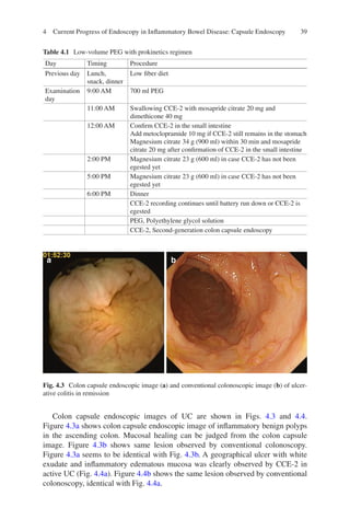 Advances In Endoscopy In Inflammatory Bowel Disease Toshiumi Hibi | PDF