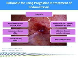 Rationale for using Progestins in treatment of
Endometriosis
* Image courtesy of Prof. Michael Mueller, Inselspital, Bern,...