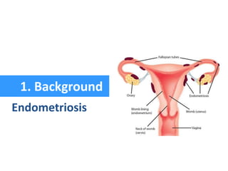 1. Background
Endometriosis
 
