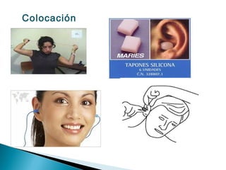 Colocación
 