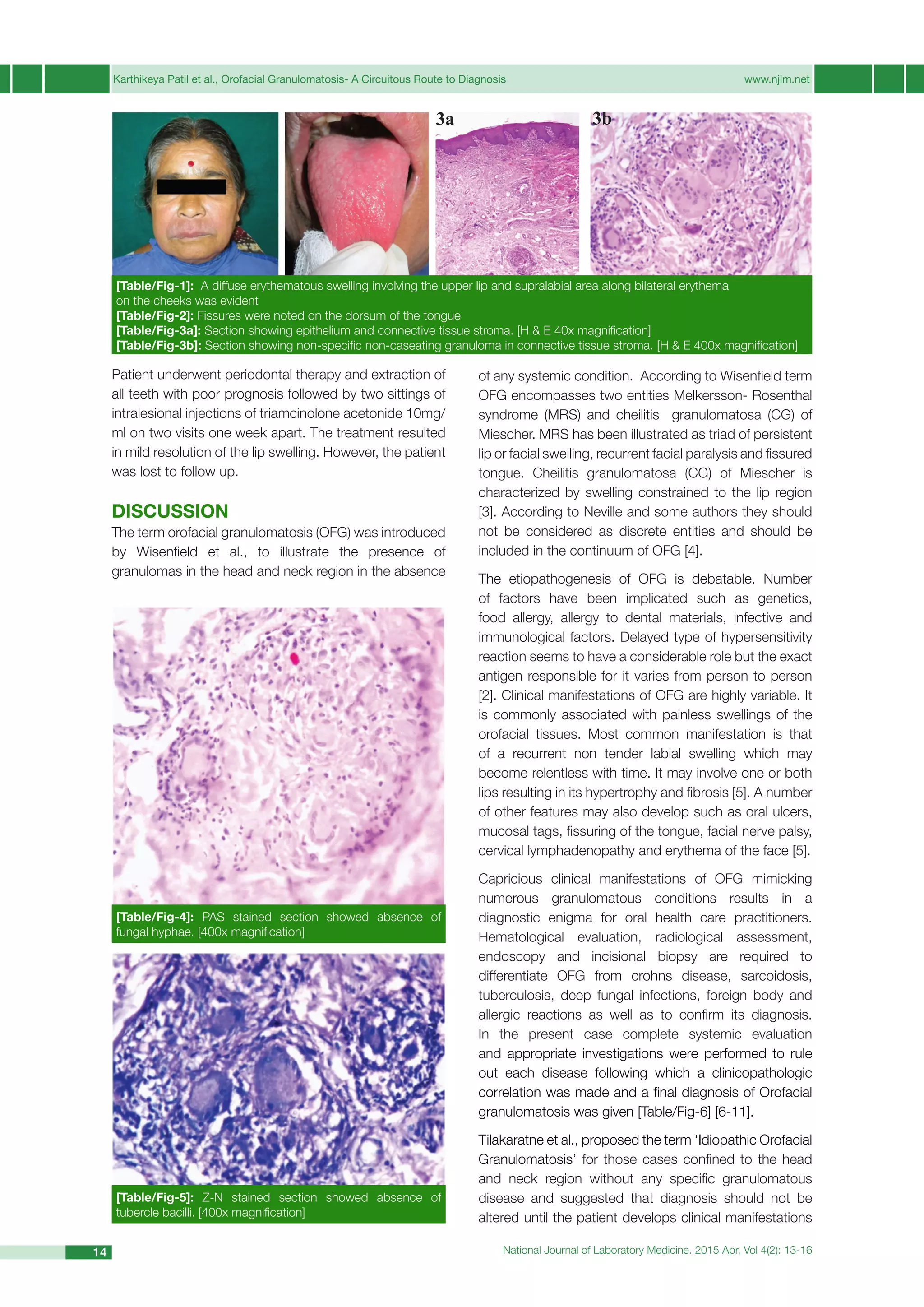 4. OROFACIAL GRANULOMATOSIS 2015 | PDF