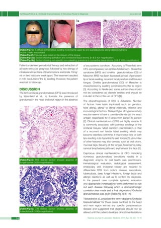 Karthikeya Patil et al., Orofacial Granulomatosis- A Circuitous Route to Diagnosis	 www.njlm.net
National Journal of Laboratory Medicine. 2015 Apr, Vol 4(2): 13-1614
Patient underwent periodontal therapy and extraction of
all teeth with poor prognosis followed by two sittings of
intralesional injections of triamcinolone acetonide 10mg/
ml on two visits one week apart. The treatment resulted
in mild resolution of the lip swelling. However, the patient
was lost to follow up.
Discussion
The term orofacial granulomatosis (OFG) was introduced
by Wisenfield et al., to illustrate the presence of
granulomas in the head and neck region in the absence
of any systemic condition. According to Wisenfield term
OFG encompasses two entities Melkersson- Rosenthal
syndrome (MRS) and cheilitis granulomatosa (CG) of
Miescher. MRS has been illustrated as triad of persistent
lip or facial swelling, recurrent facial paralysis and fissured
tongue. Cheilitis granulomatosa (CG) of Miescher is
characterized by swelling constrained to the lip region
[3]. According to Neville and some authors they should
not be considered as discrete entities and should be
included in the continuum of OFG [4].
The etiopathogenesis of OFG is debatable. Number
of factors have been implicated such as genetics,
food allergy, allergy to dental materials, infective and
immunological factors. Delayed type of hypersensitivity
reaction seems to have a considerable role but the exact
antigen responsible for it varies from person to person
[2]. Clinical manifestations of OFG are highly variable. It
is commonly associated with painless swellings of the
orofacial tissues. Most common manifestation is that
of a recurrent non tender labial swelling which may
become relentless with time. It may involve one or both
lips resulting in its hypertrophy and fibrosis [5]. A number
of other features may also develop such as oral ulcers,
mucosal tags, fissuring of the tongue, facial nerve palsy,
cervical lymphadenopathy and erythema of the face [5].
Capricious clinical manifestations of OFG mimicking
numerous granulomatous conditions results in a
diagnostic enigma for oral health care practitioners.
Hematological evaluation, radiological assessment,
endoscopy and incisional biopsy are required to
differentiate OFG from crohns disease, sarcoidosis,
tuberculosis, deep fungal infections, foreign body and
allergic reactions as well as to confirm its diagnosis.
In the present case complete systemic evaluation
and appropriate investigations were performed to rule
out each disease following which a clinicopathologic
correlation was made and a final diagnosis of Orofacial
granulomatosis was given [Table/Fig-6] [6-11].
Tilakaratne et al., proposed the term ‘Idiopathic Orofacial
Granulomatosis’ for those cases confined to the head
and neck region without any specific granulomatous
disease and suggested that diagnosis should not be
altered until the patient develops clinical manifestations
[Table/Fig-1]: A diffuse erythematous swelling involving the upper lip and supralabial area along bilateral erythema
on the cheeks was evident
[Table/Fig-2]: Fissures were noted on the dorsum of the tongue
[Table/Fig-3a]: Section showing epithelium and connective tissue stroma. [H & E 40x magnification]
[Table/Fig-3b]: Section showing non-specific non-caseating granuloma in connective tissue stroma. [H & E 400x magnification]
3a 3b
[Table/Fig-4]: PAS stained section showed absence of
fungal hyphae. [400x magnification]
[Table/Fig-5]: Z-N stained section showed absence of
tubercle bacilli. [400x magnification]
 